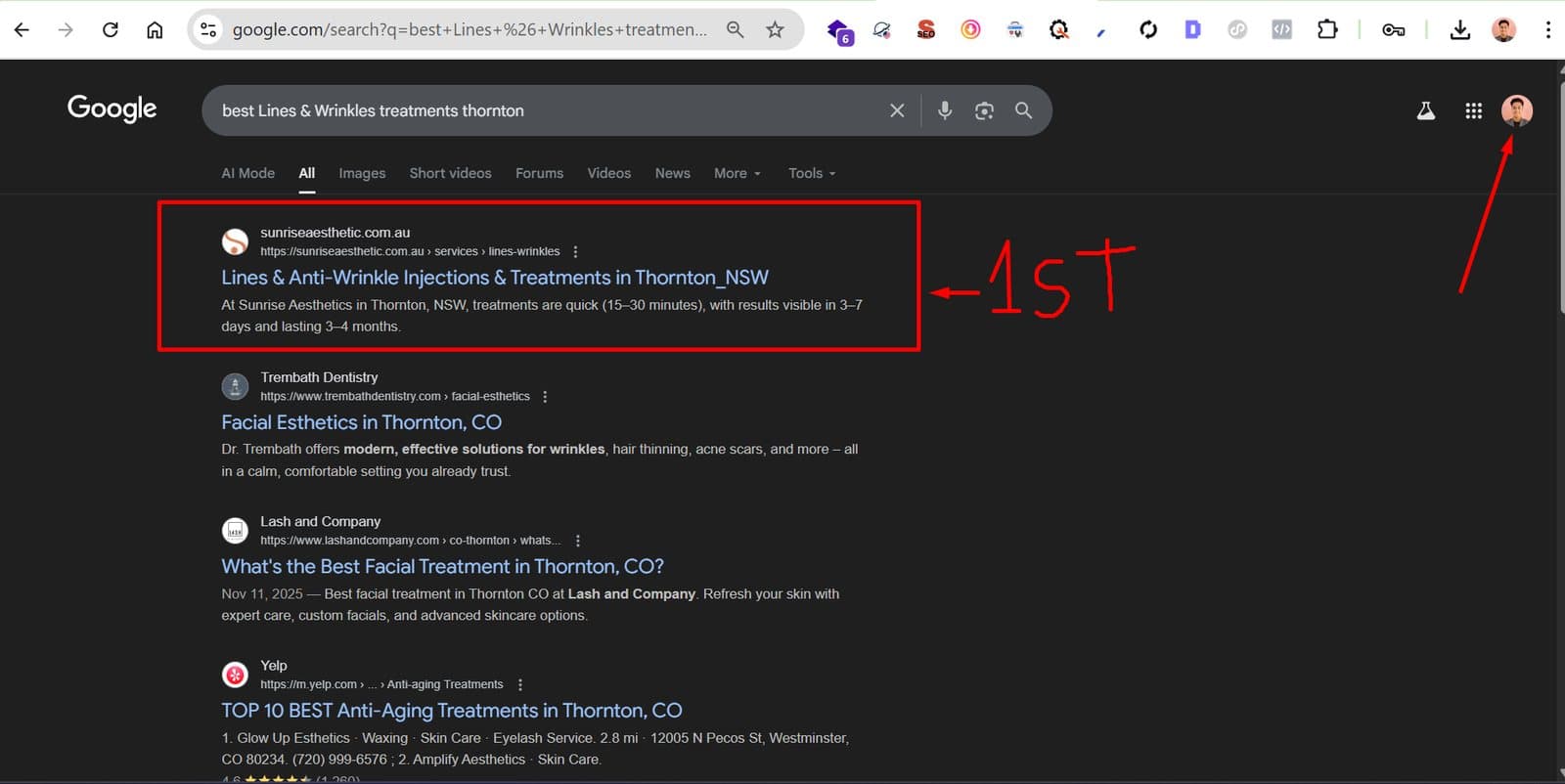 Google · #1 for “best lines & wrinkles treatments thornton”